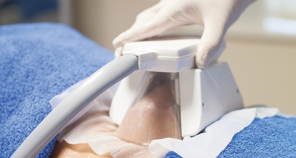 How Fat Freezing and HIFU Work Together? 2 Multiple Areas in One Session HIFU and Fat Freezing Bexleyhill