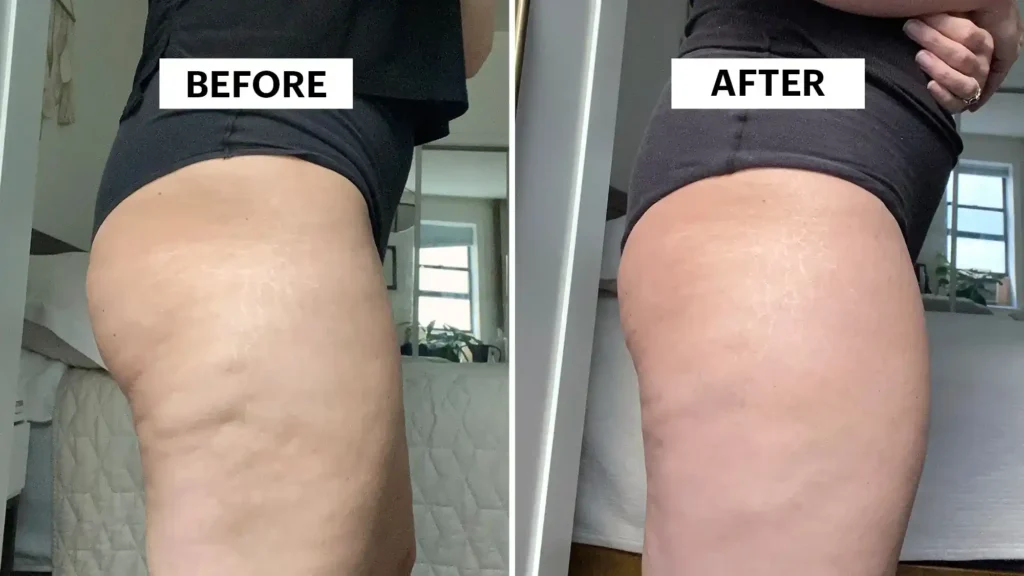 Do Toning Exercise Bexleyhill Really Tackle Cellulite?