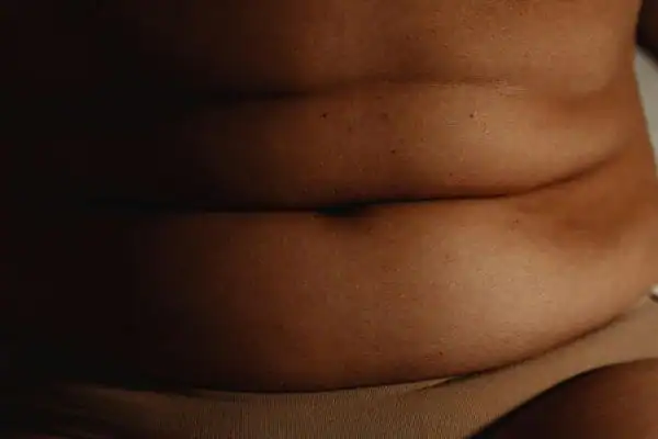 The Hidden Connection: How Stress Shapes Your Fitness and Body Composition 3 image of what stress can do on the stomach area and how Lipo 360 Bexleyhill can help to change your body shape.