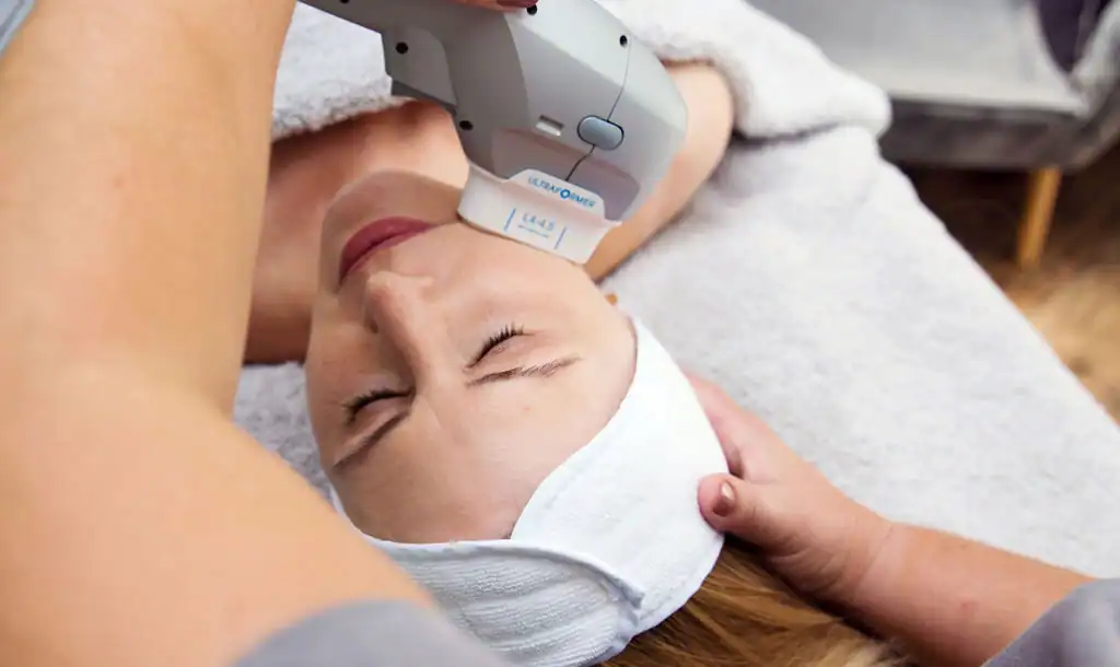 Discover the Perfect Duo: Morpheus8 and HIFU 1 Image of Morpheus8 And HIFU Bexleyhill combined treatment